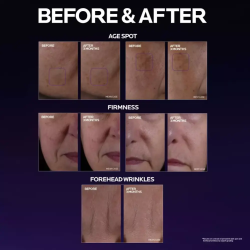 سيروم ميلا بي 3 المكثف لتصحيح البقع الداكنة من لاروش بوزيه - 40 مل  La Roche-Posay Mela B3 Serum